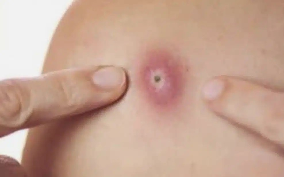 Προσοχή!! Αυτά είναι ξεκάθαρα σημάδια ότι αυτό είναι…