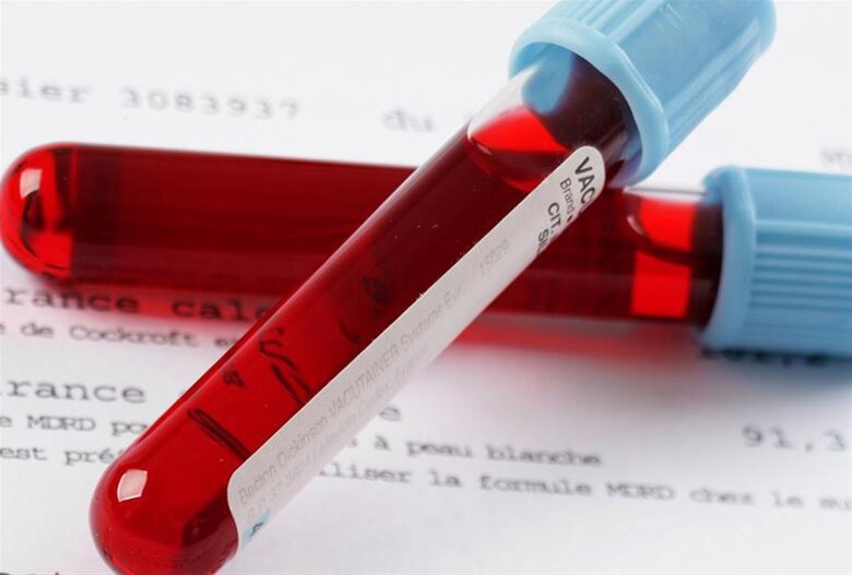 Πότε η γενική αίματoς δείχνει καρκίνο