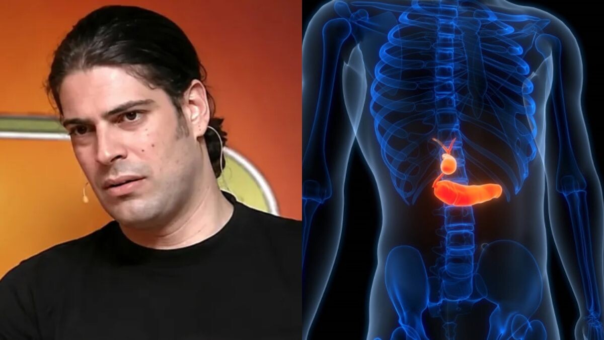 Με αφορμή τον θάνατο του Λορέντζο Καριέρε: Οι 7 ενδείξεις του καρκίνου στο πάγκρεας