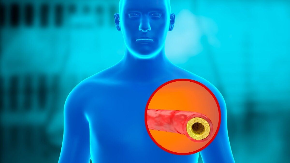 Η εξέταση που προβλέπει τον κίνδυνο θανάτου από καρδιακό επεισόδιο εντός πενταετίας