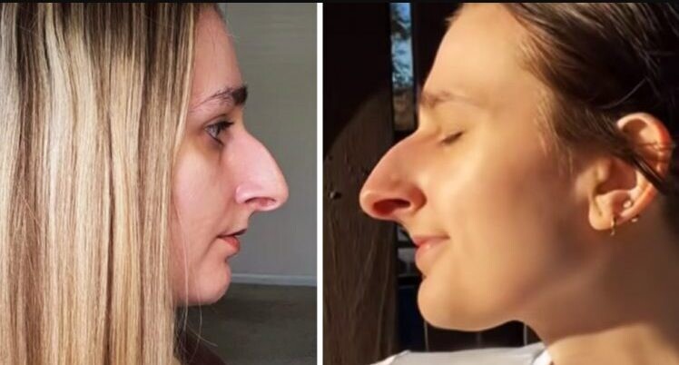 Ο φίλος της της έθεσε έναν όρο: «Θα σε παντρευτώ αφού κάνω πλαστικn στη μύτη μου» — Αλλά Auτo που έκανε η κοπέλα, δεν το περίμενε κανείς