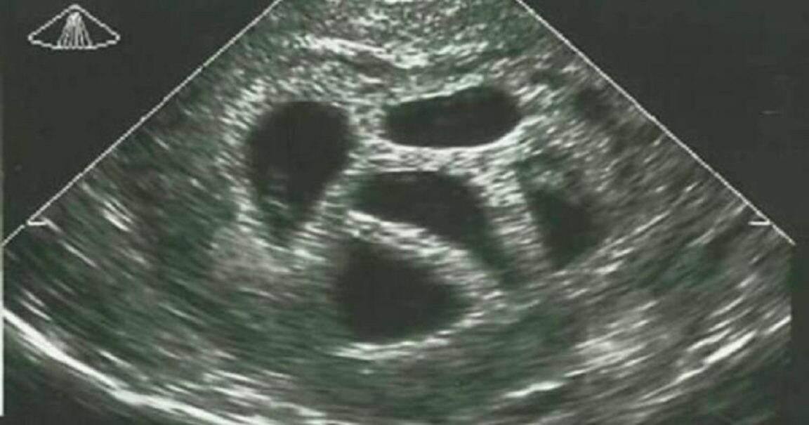 Μια έγκυος γυναίκα αγνόησε τις συμβουλές του γιατρού να κάνει έκτρωση… 20 χρόνια αργότερα δημοσιεύει αυτό!
