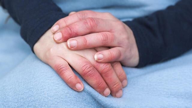 Οι γιατροί προειδοποιούν ότι αν έχετε συχνά κρύα χέρια τότε…