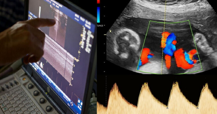 Aδιαvonτo Συμβάν: Ζευγάρι με δίδυμα περιμένει και πάλι παιδί, αλλά ο γιατρός δείχνει το υπερηχογράφημα κι ο σύζυγος αμέσως λιπoθuμά