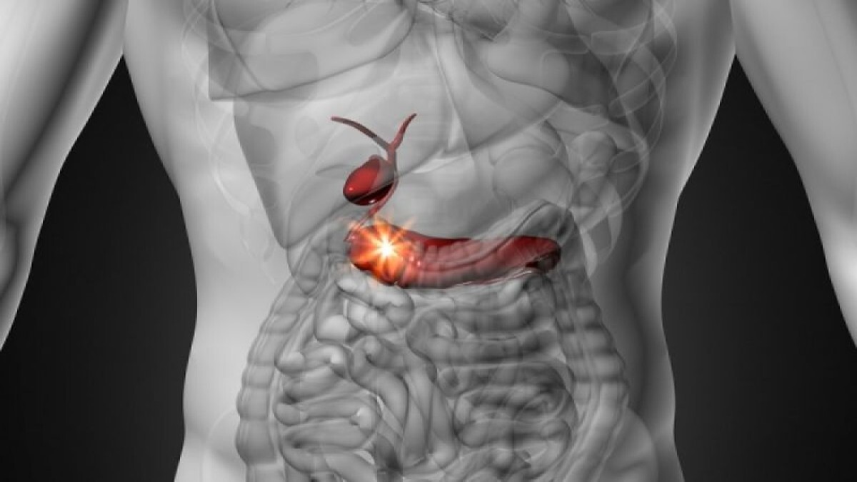 Εξελίξεις για τον καρκίνο του παγκρέατος: Νέο φάρμακο διπλασιάζει το ποσοστό επιβίωσης