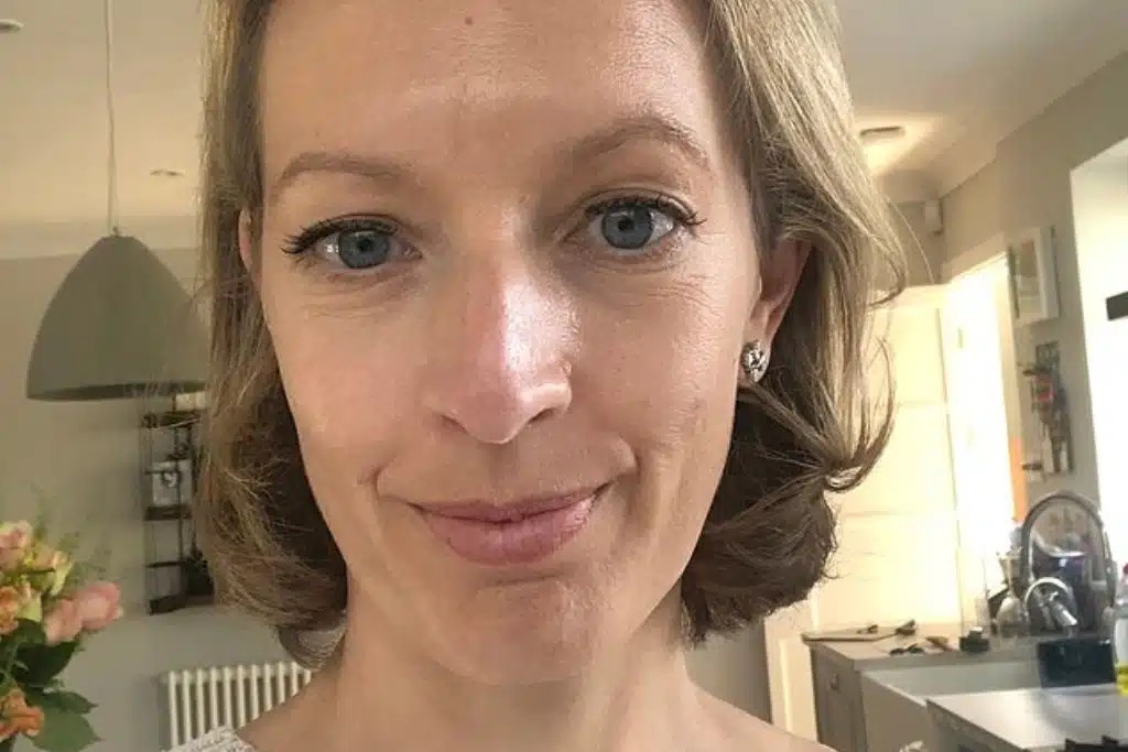 Γιατροί έμειναν άφωνοι: 45χρονη που υπέφερε από ίλιγγο και ζαλάδες βρήκε τη λύση με μια φυσική θεραπεία που της πρότειναν – Της άλλαξε τη ζωή