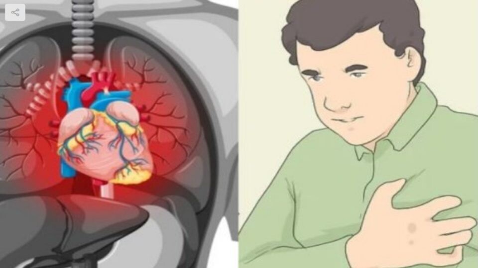 Αν στο δέρμα σας συμβαίνει αυτό, έχετε αυξημένο κίνδυνο καρδιακής προσβολής