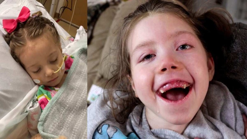 4χρονη έπαθε εγκεφαλική βλάβη από αποσμητικό, γιατί η μητέρα της έκανε ένα λάθος που κάνουν πολλοί γονείς