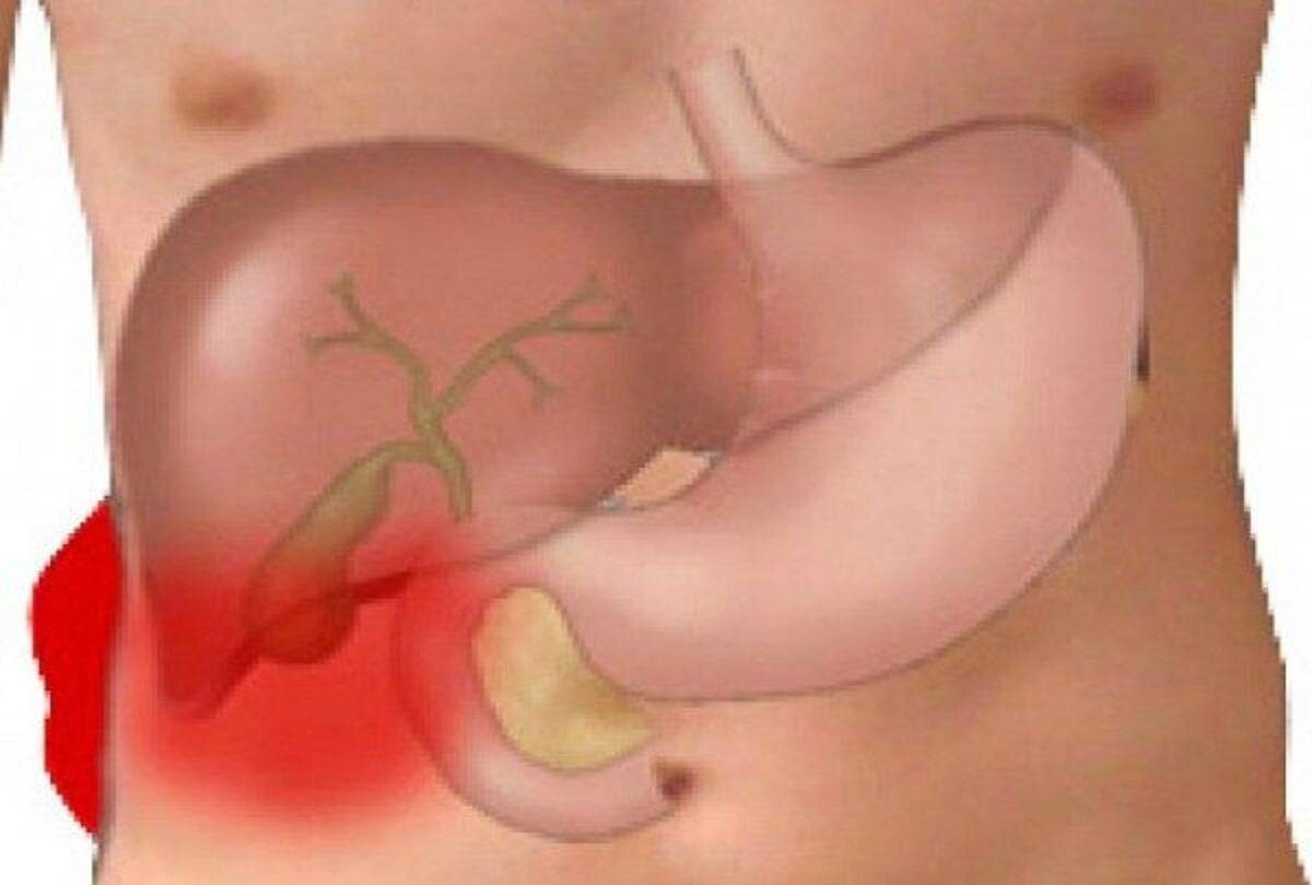 Το «φάρμακο του φτωχού»: Η πάμφθηνη τροφή για ένα Υγιές έντερο