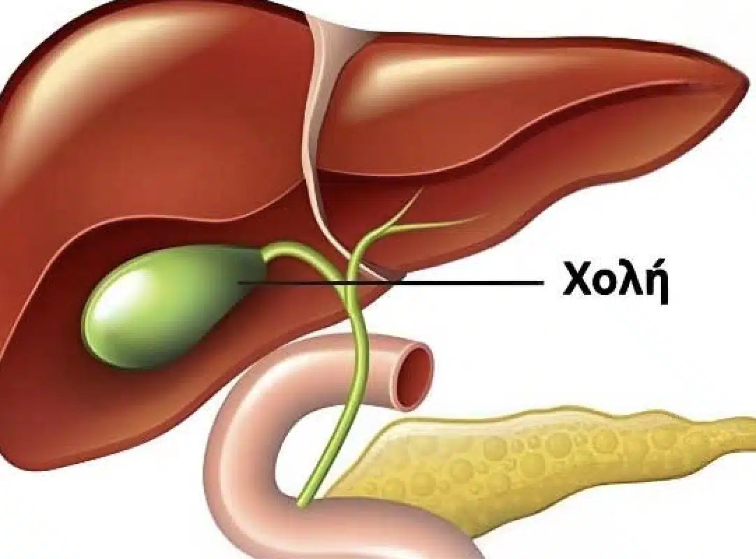 Τι συμβαίνει στο σώμα μετά την αφαίρεση της χοληδόχου κύστης;
