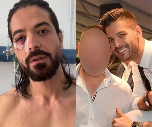 Άρης Μουγκοπέτρος: Η «ύποπτη» ανάρτηση του φίλου του λίγο πριν του δώσει την κροτίδα που την κατέβασε αμέσως μετά την έκρηξη – Η 4 λέξεις που έγραφε