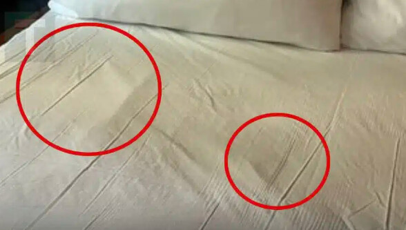 Οι γιατροί προειδοποιούν: Auτό το 1 σημάδι καρκίνου μπορεί να φανεί στα σεντόνια σας