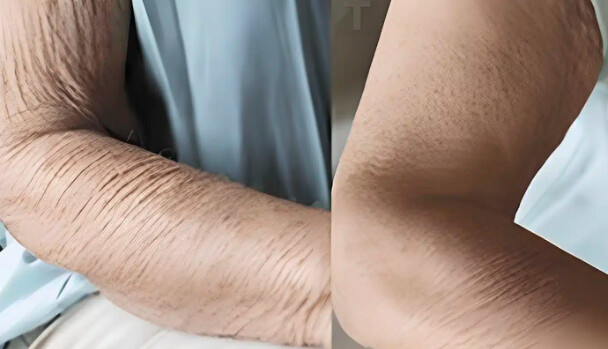 Πώς να φροντίσετε το δέρμα που γερνάει