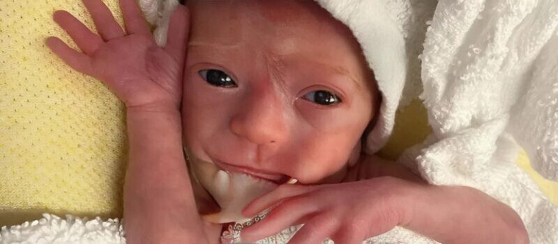 Όλοι στο δωμάτιο του νοσοκομείου πάγωσαν· κανείς δεν καταλάβαινε γιατί η σιωπή ήταν τόσο βαριά, μέχρι που τελικά συνειδητοποίησαν το αδιανόητο