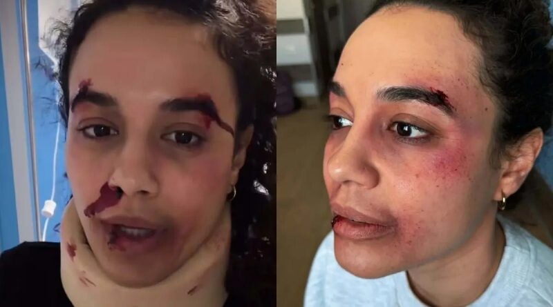 Πηνελόπη Πλάκα: «Πήρα έτσι τη μαμά μου, το ξέρω ήτανε χοντρό»