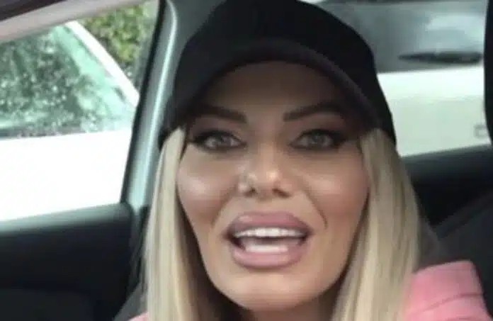 Αγνώριστη πασίγνωστη Ελληνίδα – Έγινε άλλος… άνθρωπος από τις επεμβάσεις