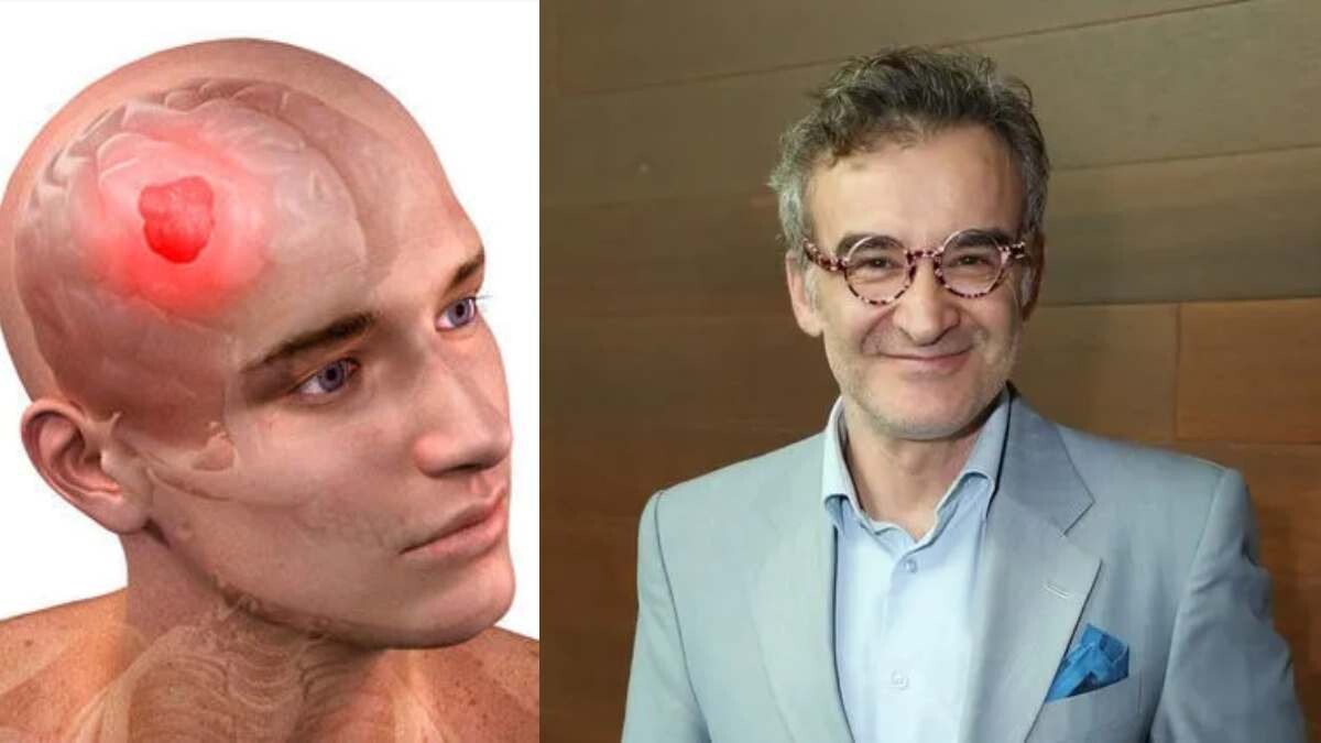 Eγxειpiστnκε για oγκo στον εγκέφαλο ο Νίκος Ορφανός: Τα Yπouλα σuμπτώματα και η σύγχρονη αντιμετώπιση