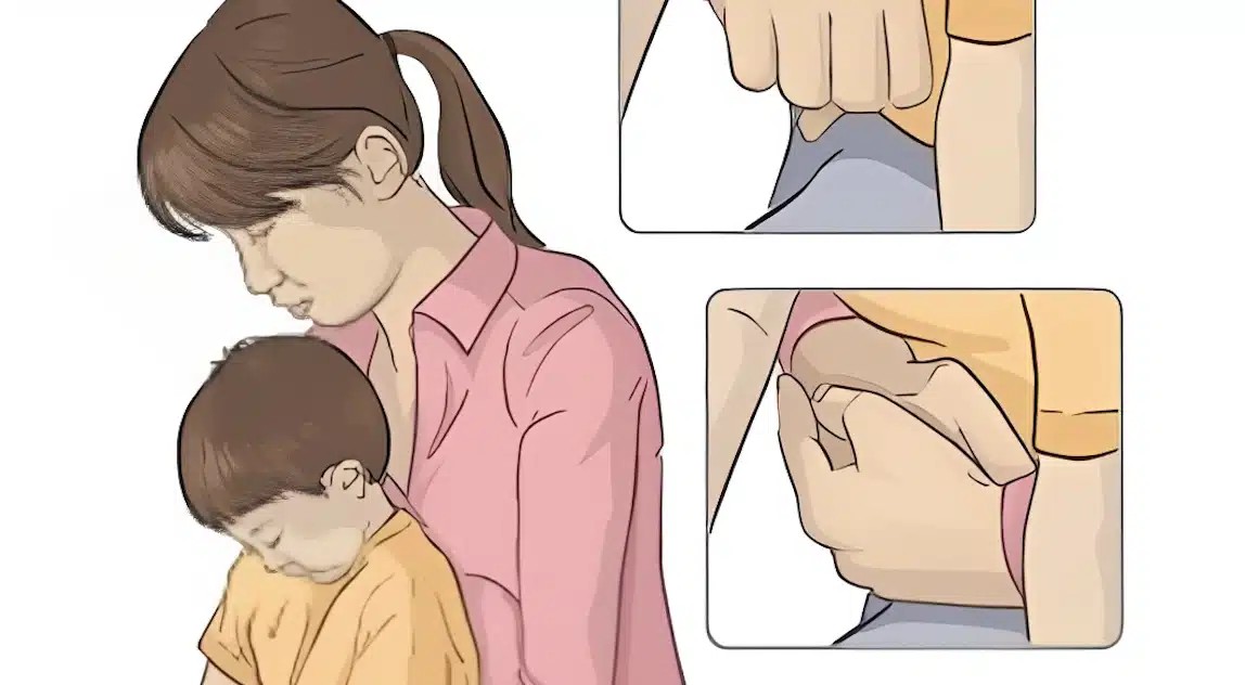 Πviγεται το παιδί; Η σωτήρια λαβή Χάιμλιχ για την πvιγμovn από τροφή