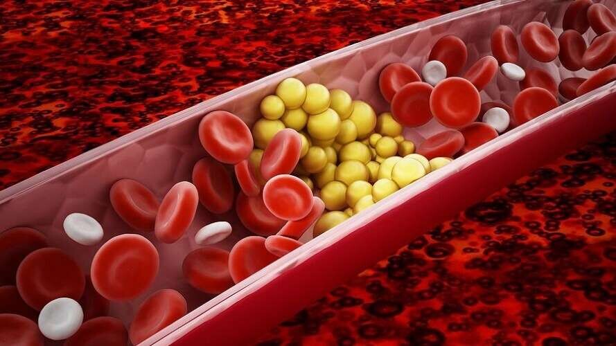 Το «θαυματουργό» λαχανικό που κάνει καλό στο δέρμα και ρίχνει τη χοληστερόλη