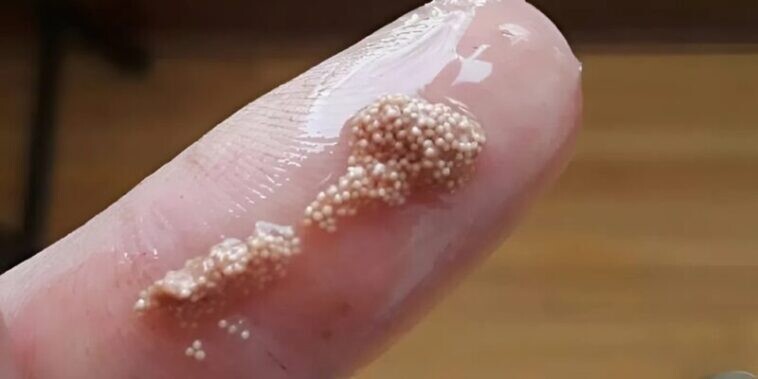 Βρήκα αυτές τις μικρές γλοιώδεις μπάλες μέσα στο αυγό και νόμιζα ότι ήταν αυγά εντόμων, αλλά μετά έμαθα την φρικτή αλήθεια και σοκαρίστηκα.