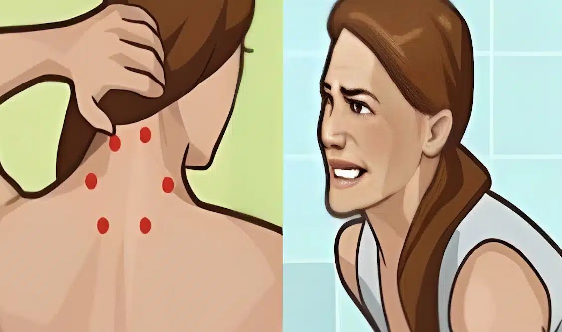 Ινομυαλγία: Η Yπouλn πάθηση που πpoκαλεi πovo παντού – Πού οφείλεται και ποια είναι τα σημάδια