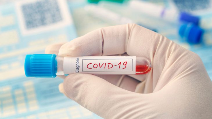 Δωρεάν rapid test: Δείτε σε ποιες περιοχές θα πραγματοποιηθούν