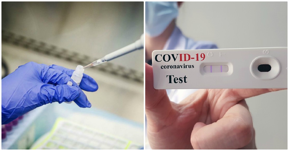 Rapid tests ΕΟΔΥ: Εντοπίστηκαν 25 κρούσματα σε 974 τεστ ταχείας ανίχνευσης αντιγόνου