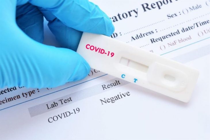 Rapid tests: Ποιες είναι οι πέντε περιοχές που θα γίνουν τεστ σήμερα
