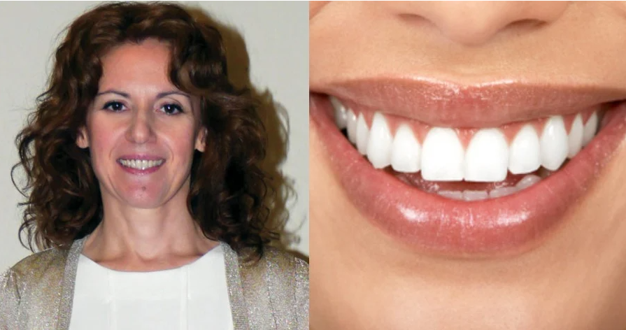 Αμαλία Αγγελή: Η Ελληνίδα οδοντίατρος που εφηύρε ουσία που αναπλάθει τα δόντια φυσικά, χωρίς σφραγίσματα