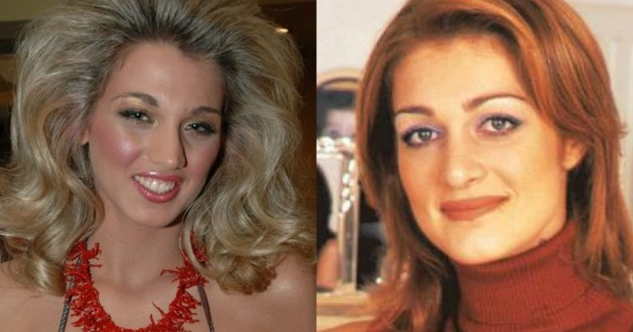 Εφτά διάσημες γυναίκες πριν και μετά την πλαστική εγχείρηση μύτης