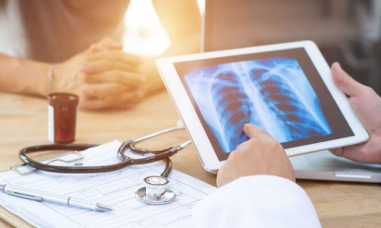 Προειδοποίηση σοκ από τους γιατρούς! Μεγαλύτερο κίνδυνο να πάθουν καρκίνο ακόμη και από τους καπνιστές έχουν όσοι…