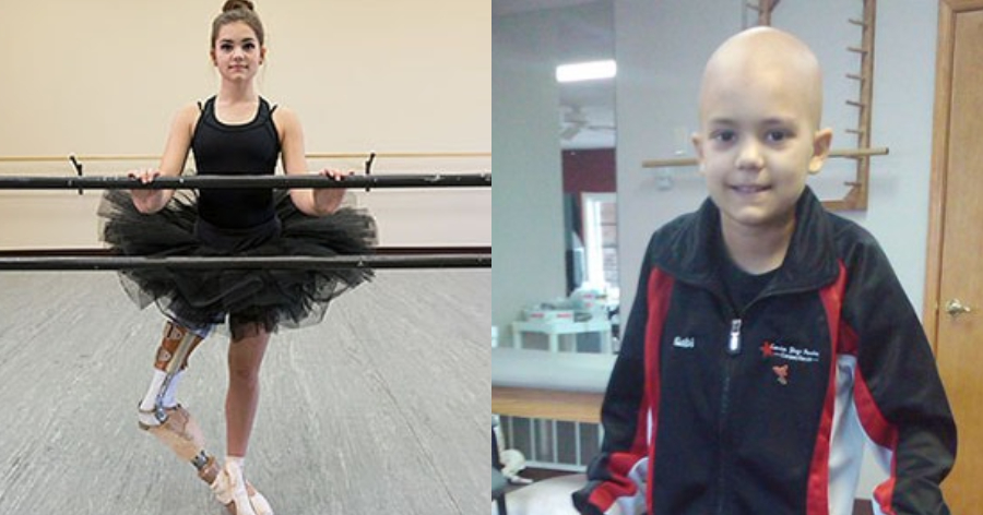 Έχασε το πόδι της από καρκίνο και σήμερα χορεύει ξανά: Η ιστορία μιας 15χρονης μπαλαρίνας