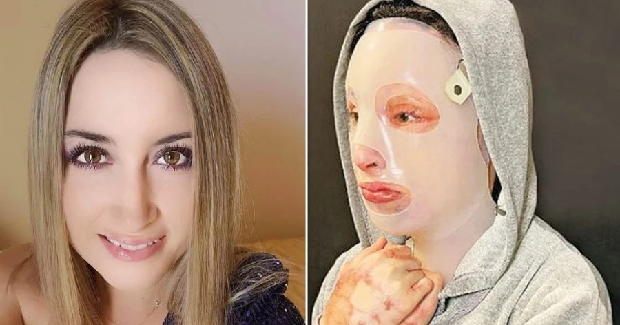 «Πάρε 150.000€ και λιώσε της το πρόσωπο»: Σοκαριστικό πρωτοσέλιδο για την υπόθεση με το βιτριόλι
