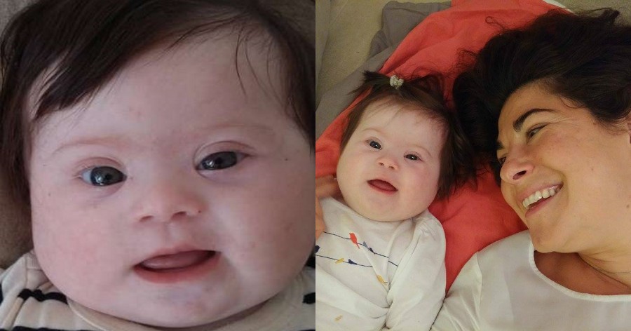 Λουίζα: Η 4 μηνών κόρη μου με δύο χέρια, δύο πόδια, κι ένα έξτρα χρωμόσωμα