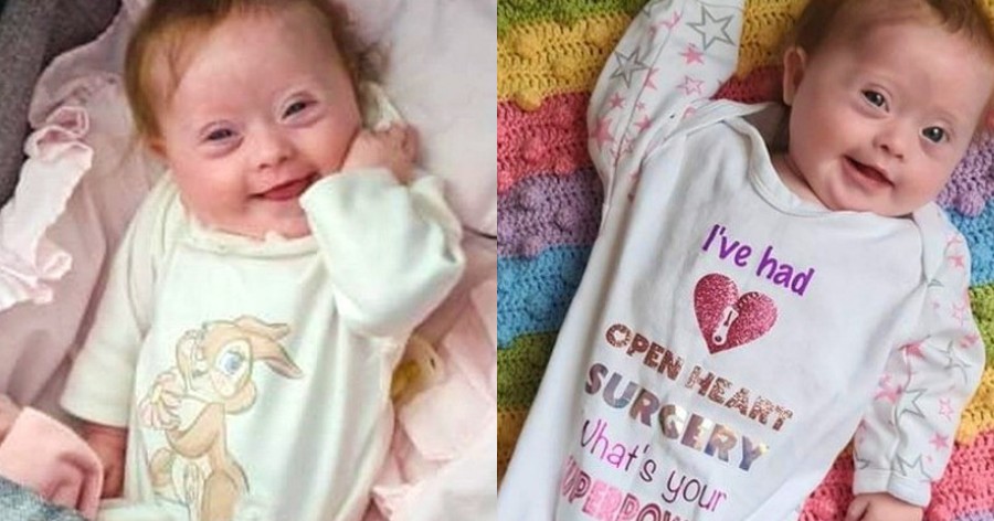 Νεογέννητο κοριτσάκι υποβλήθηκε σε επέμβαση καρδιάς, πέρασε 25 ώρες στην εντατική και βγήκε νικήτρια