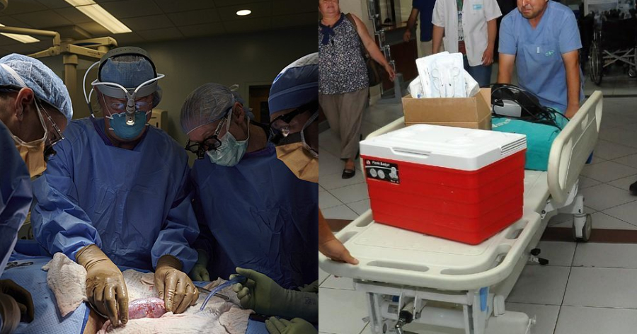 Συνέδεσαν νεφρό από χοίρο σε άνθρωπο: Η εγχείρηση στέφθηκε από επιτυχία και το νεφρό λειτουργεί