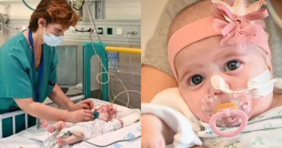 Κoριτσάκι 2 μηνών σώθηκε χάρη σε μια πρωτoπoριακή μεταμόσχευση καρδιάς