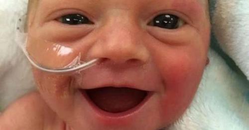 «Είναι χαρούμενη που ζει!»: Το πιο όμορφο χαμόγελο από ένα πρόωρο μωρό