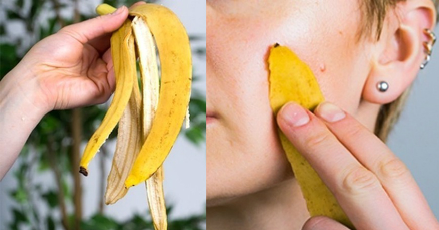Φλούδα μπανάνας: Πως να τη χρησιμοποιήσετε για να λύσετε καθημερινά προβλήματα και να γλιτώσετε χρήματα