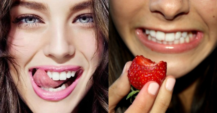 Κατάλευκα δόντια: Τα σπιτικά κόλπα για ένα λαμπερό χαμόγελο χωρίς επίσκεψη στον οδοντίατρο