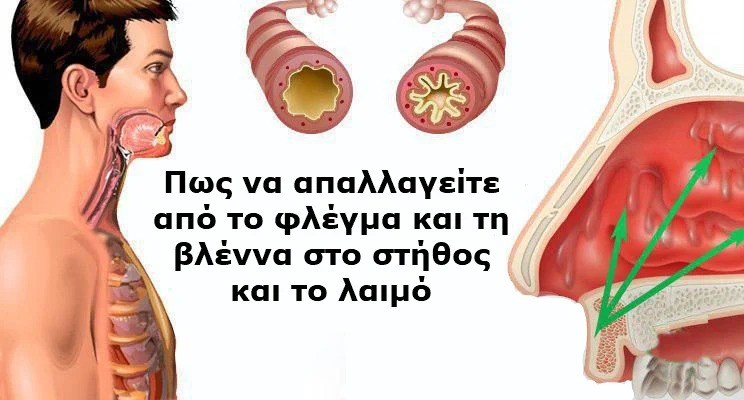 Έξι φυσικές θεραπείες για να απαλλαγείτε από το επίμονο φλέγμα και τη βλέννα στο στήθος και το λαιμό