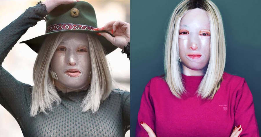 Όμορφη και χωρίς τη μάσκα: Η Ιωάννα Παλιοσπύρου για πρώτη φορά είναι έτοιμη να δείξει το πρόσωπο της μετά την επίθεση