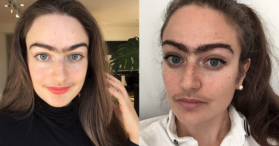 Κοπεγχάγη: Η 31χρονη σταμάτησε να βγάζει φρύδια και μουστάκι –  Νιώθει θηλυκή ακόμη και με τις τρίχες της