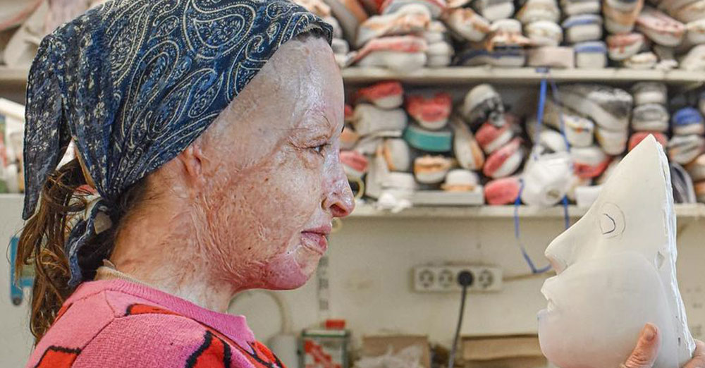 «Πρότυπα σαν και εσένα θέλουμε!»: Πανελλήνια υπόκλιση στην Ιωάννα Παλιοσπύρου που έδειξε το πρόσωπό της