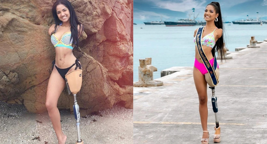 Η δύναμη της θέλησης έχει το δικό της πρόσωπο και είναι αυτό της Βικτόριας από τον Ισημερινό – Το μοντέλο που ξεχωρίζει στο Instagram