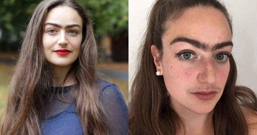 Κοπεγχάγη: Η 31χρονη που σταμάτησε να βγάζει φρύδια και μουστάκι γιατί νιώθει θηλυκή ακόμη και με τις τρίχες της