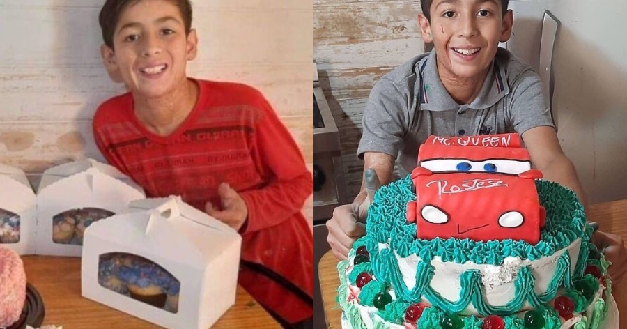 Joaquin: Η ιστορία του 10χρονου με σοβαρά εγκαύματα ο οποίος πληρώνει μόνος του, τις επεμβάσεις του φτιάχνοντας τούρτες