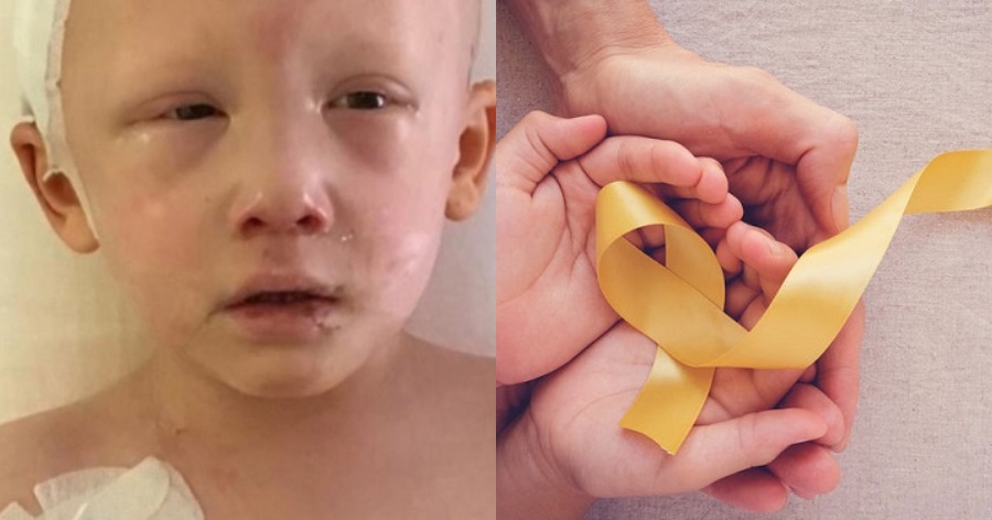 Ψιθύρισε 3 λέξεις και τους “πάγωσε” όλους: 3χρονο αγοράκι με καρκίνο ανοίγει τα μάτια του για τελευταία φορά