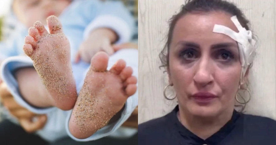 Μεγάλη Βρετανία: Γυναίκα πούλησε το νεογέννητο παιδί της για να κάνει πλαστική στη μύτη