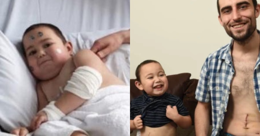 Αληθινή ιστορία: Μπαμπάς δώρισε το νεφρό του στον 4χρονο γιο του και του έσωσε τη ζωή